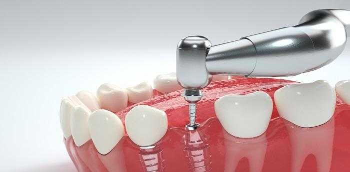 孕妇梦见牙齿掉了是什么意思