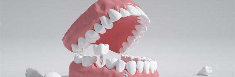 做梦梦到咬碎全口的牙,梦境背后的深层含义与心理解析 做梦梦到咬碎全口的牙,梦境背后的深层含义与心理解析