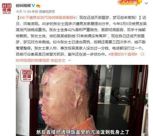 女人梦见自己秃了一片